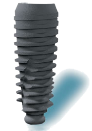 Vis d'implant dentaire Cannes